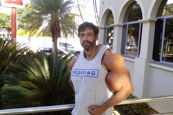 ¡Quería más músculos! Muere fisiculturista 'El Hulk' tras inyectarse aceite