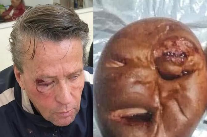 ¡No se pasen! Crean pan inspirado en Alfredo Adame golpeado