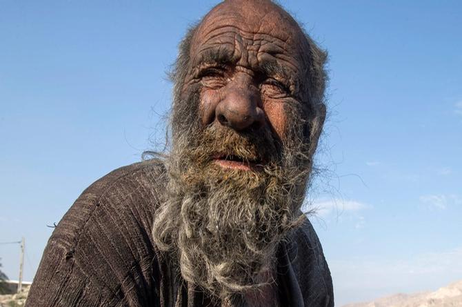 Muere el hombre más sucio del mundo; tenía 60 años sin bañarse (+fotos)