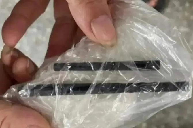 ¿Brujería? Tenía dolores de cabeza y hallan en su cerebro palillos clavados
