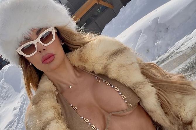 Ninel Conde se accidenta en plenas vacaciones 