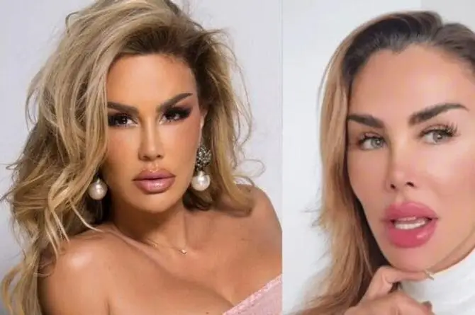 Ninel Conde anuncia su nueva cirugía