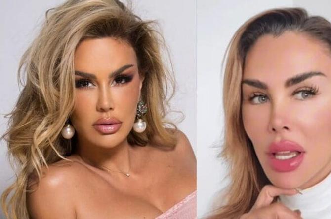 Ninel Conde anuncia su nueva cirugía