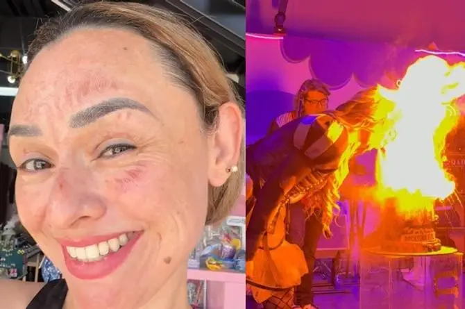 Hace reto viral en su cumpleaños ¡Y se queda sin cejas y pestañas! (+video)