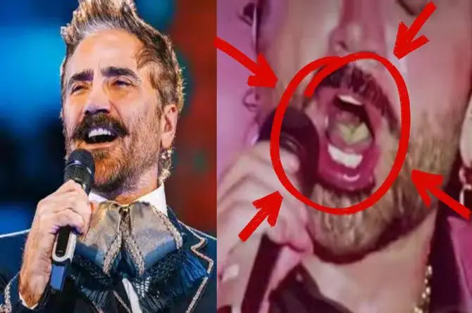 Alejandro Fernández preocupa por el color de su lengua durante concierto y desata debate en redes