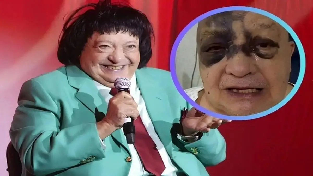 Luis de Alba reaparece golpeado y preocupa su estado de salud (+video)